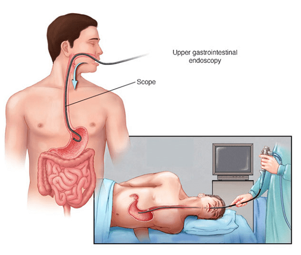 Endoscopy